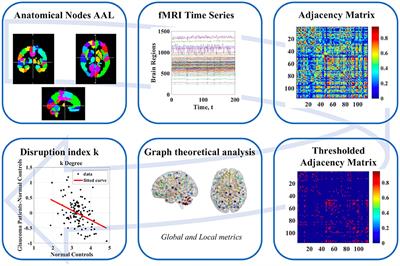 Primary Open Angle Glaucoma Is Associated With Functional Brain Network Reorganization